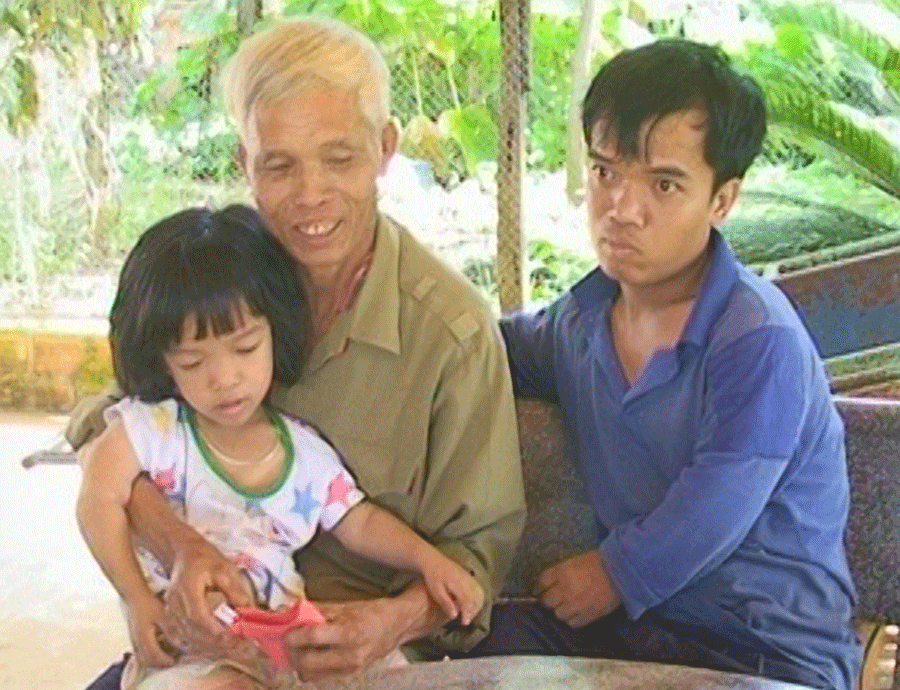 Gia đình ông Nguyễn Đức Diễn có 3 thế hệ đều nhiễm chất độc da cam. Ảnh: L.T