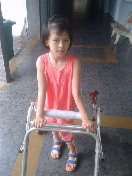 Sau khi ghép tế bào gốc, bé Nhật Lam đã tự đi lại được. (Nguồn: Vinmec)