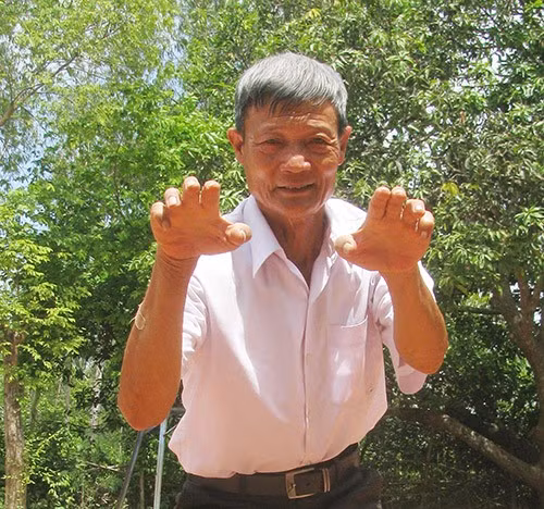 Võ sư Lý Xuân Hỷ. Ảnh: H.TRỌNG