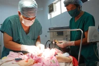 Gia Lai: Cấp cứu thành công bệnh nhi sơ sinh bị thoát vị thành bụng