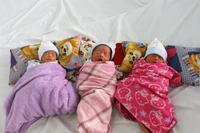 Cấp cứu thành công sản phụ mang tam thai bị tiền sản giật