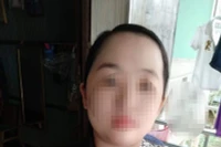 "Bão mẫu" dùng tay đánh vào đầu bé trai tổn thương não 99%