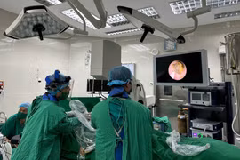 Bước tiến lớn trong điều trị sỏi mật