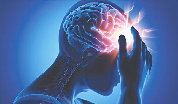 Ngáp quá nhiều cũng có thể do u thùy trán hoặc u thân não. Ảnh: Internet