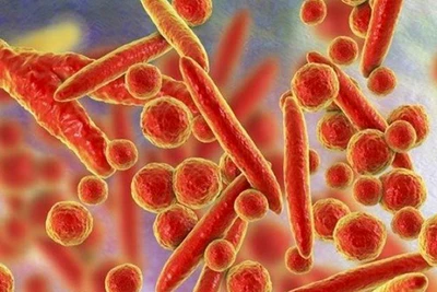 Vi khuẩn liên quan bệnh hô hấp ở Nga từng ghi nhận tại Việt Nam