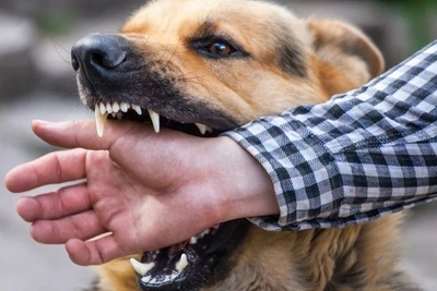 Đắk Lắk: Ghi nhận ca tử vong thứ 5 nghi do bệnh dại từ đầu năm đến nay