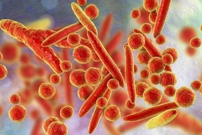 WHO bác thông tin về virus lạ gây triệu chứng ho ra máu ở Nga