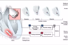 Trung Quốc nghiên cứu thành công máy tạo nhịp tim tự cấp điện siêu nhỏ