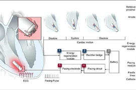 Trung Quốc nghiên cứu thành công máy tạo nhịp tim tự cấp điện siêu nhỏ