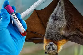 Bộ Y tế ban hành hướng dẫn chẩn đoán và điều trị bệnh do virus Nipah
