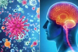 Bộ Y tế yêu cầu triển khai biện pháp phòng - chống bệnh viêm màng não mô cầu