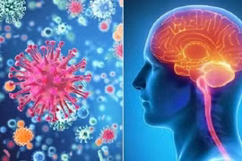 Bộ Y tế yêu cầu triển khai biện pháp phòng - chống bệnh viêm màng não mô cầu