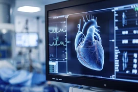 AI có thể phát hiện chính xác nhiều bệnh tim quan trọng chỉ từ hình ảnh siêu âm