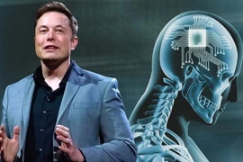 Chỉ mất 1,5 giây để cấy chip vào não người