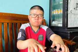 Ước mơ chinh phục giảng đường đại học của cậu học trò mồ côi, mắc bệnh hiểm nghèo 