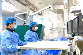 Đừng để bị đột quỵ vì thói quen không tốt