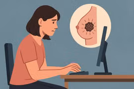 Ngồi nhiều, ít vận động làm tăng nguy cơ ung thư vú