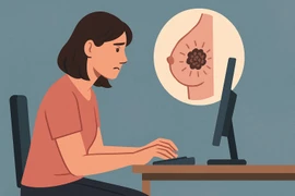 Ngồi nhiều, ít vận động làm tăng nguy cơ ung thư vú