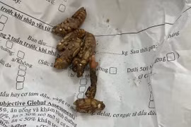 Ngộ độc do ăn nấm mọc trên nhộng ve sầu