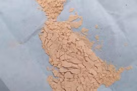 Đặt nội khí quản cứu cháu bé vì cha mẹ tưa lưỡi bằng thuốc cam