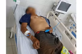 Vụ ngộ độc do ăn bọ xít tại Gia Lai: Bệnh nhân đã tử vong