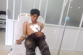 Nổ mìn khi đi đánh cá khiến 2 người bị thương