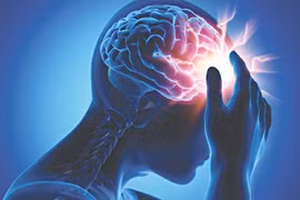 42,5% dân số thế giới mắc chứng rối loạn thần kinh