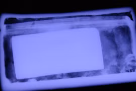 Kết quả X-quang có thay đổi 'bản đồ' xá lị của Phật hoàng Trần Nhân Tông?