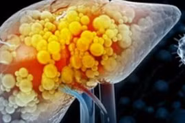 Một loại vắc xin 'rất quen' có thể làm teo khối u ung thư gan