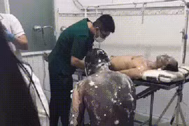 Bình Dương: Nổ lớn ở công ty gỗ, nhiều công nhân bỏng nặng