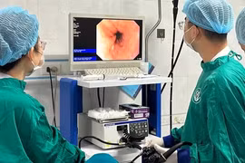 Vì sao đa số người mắc ung thư đại trực tràng phát hiện trễ?