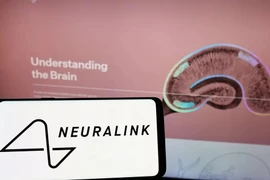 Neuralink thành công bước đầu trong thử nghiệm cấy chip vào não người