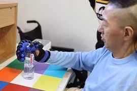 Trung Quốc phát triển giải pháp cấy ghép não an toàn hơn Neuralink