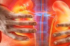 Dấu hiệu đau lưng thực ra là sỏi thận