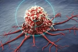 Tạo ra loại thuốc 'chỉ sau vài ngày đã làm khối u ung thư biến mất'