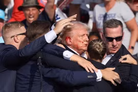 Rối não, tai ông Trump chảy máu do trúng đạn hay thứ gì khác ?