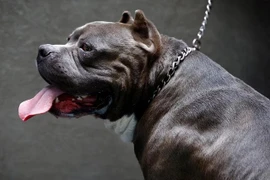 Bé gái 4 tuổi bị chó Pitbull lên cơn dại cắn nát mặt