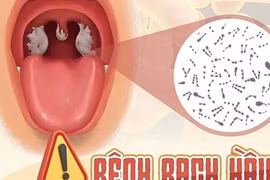 Bệnh bạch hầu: Nguồn lây không ngờ và các tình huống tiếp xúc gần