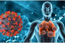 Phát hiện mới ở những người không tiêm vắc xin bị mắc Covid-19