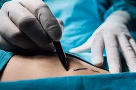 Báo Ukraine: Cựu Thứ trưởng Y tế đứng đầu đường dây đánh cắp nội tạng