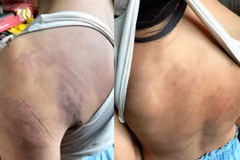 Đắk Lắk: Làm rõ vụ học sinh lớp 4 bị 10 bạn học đánh