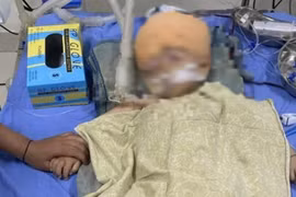 Cháu bé 1 tuổi bị chấn thương não ở trường mầm non