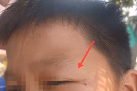 Công an TP Buôn Ma Thuột thụ lý vụ 5 cháu nhỏ bị đánh