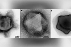 Phát hiện mầm bệnh kinh dị nhất: Virus có xúc tu bạch tuộc