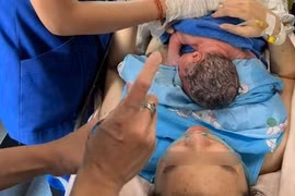 Hy hữu: Cứu thai nhi sa chân khỏi âm hộ người mẹ, giúp mẹ tròn con vuông
