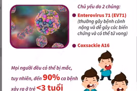 Số ca mắc bệnh tay chân miệng tăng tới 75% so với năm trước