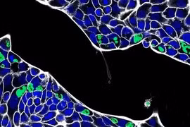 Phát hiện ra vi khuẩn đường ruột khiến nhiễm trùng tái phát ở vùng sinh dục