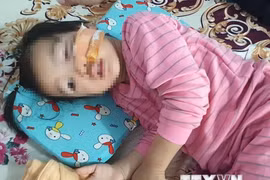 Bình Phước: Bé 3 tuổi bị hai con chó Becgie nhà hàng xóm cắn bị thương