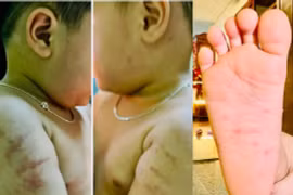 Hai trẻ bị bạo hành tại cơ sở mầm non ở Bình Định: Giáo viên nhận lỗi 