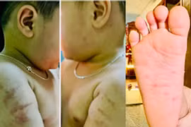 Sao mãi để trẻ bị bạo hành?